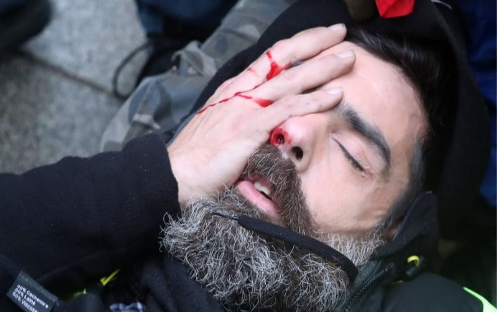 Τραυματίστηκε ηγετικό στέλεχος των «κίτρινων γιλέκων»