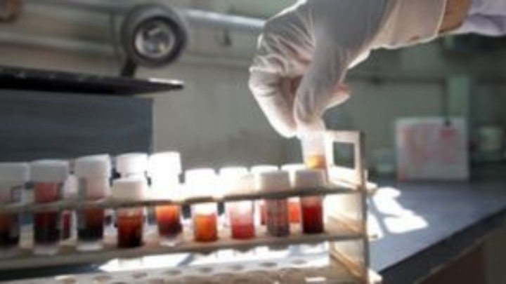 Νέα εξέταση αίματος θα ανιχνεύει τον καρκίνο του μαστού έως και πέντε χρόνια πριν την εμφάνιση των κλινικών συμπτωμάτων