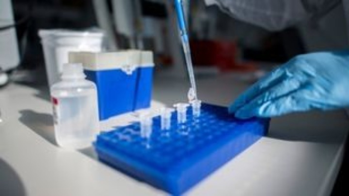 ΗΠΑ: 66χρονος θεραπεύεται από τον HIV – Ο τέταρτος ασθενής που θεραπεύεται παγκοσμίως