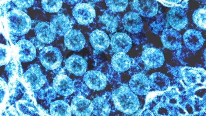 Δομινικανή Δημοκρατία: Το πρώτο κρούσμα Covid-19