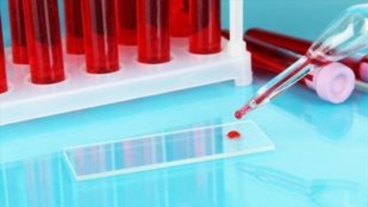 Η ανίχνευση αντισωμάτων στο αίμα, ενδεικνυόμενος τρόπος παρακολούθησης της πανδημίας