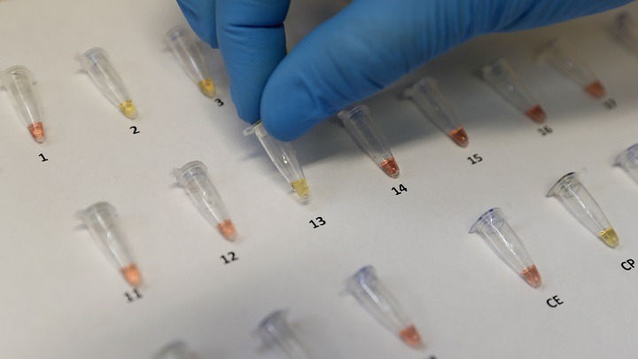 Βραζιλία-Covid-19: Πέθανε ένας από τους εθελοντές που συμμετείχε στη δοκιμή του εμβολίου της AstraZeneca