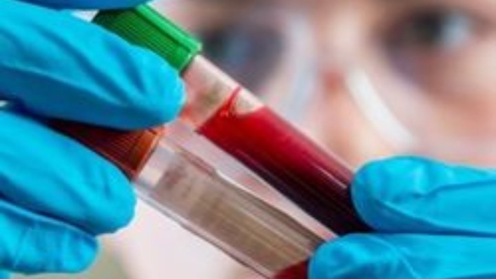 Μικρά τα οφέλη για την αποτελεσματικότητα της θεραπείας της Covid-19 με πλάσμα αίματος από αναρρώσαντες