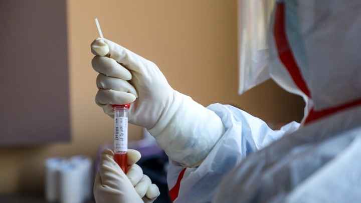 Οι ασθενείς με Covid-19 παράγουν αντισώματα ακόμη και επτά μήνες μετά από τη λοίμωξη