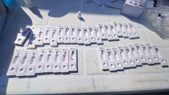 ΕΟΔΥ- 9 Σεπτεμβρίου: Σημεία δωρεάν ελέγχου Covid-19