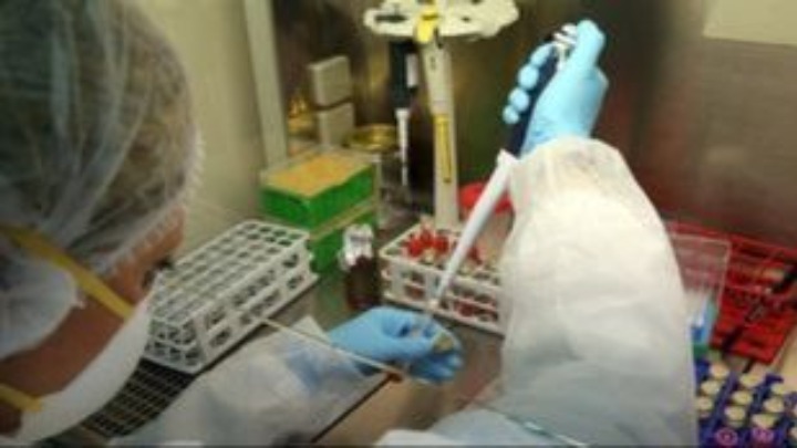 Aπώλεια όσφρησης λόγω Covid-19 – Διαστρεβλωμένες και ανύπαρκτες οσμές επί μήνες