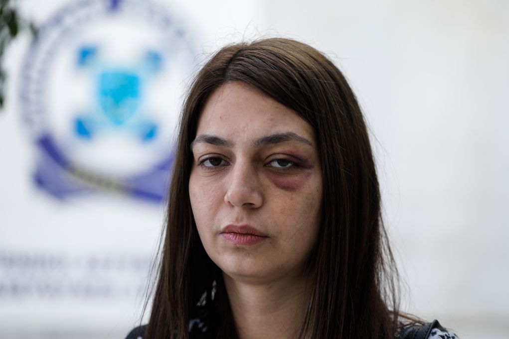 Στη ΓΑΔΑ η βουλευτής του ΜεΡΑ25 Μ. Απατζίδη για την επίθεση που δέχθηκε από δυνάμεις των ΜΑΤ (pics)