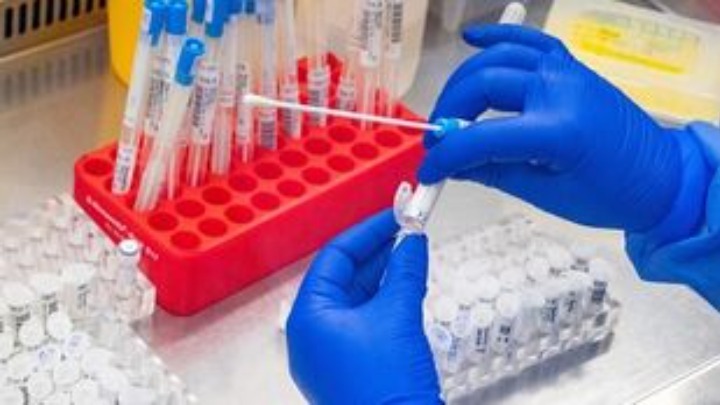 Μπορεί η ευλογιά των πιθήκων να εξελιχτεί σε νέα πανδημία;