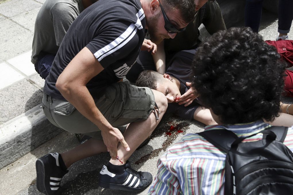 Τραυματίας φοιτητής στο ΑΠΘ: «H εκπαίδευση και η καταστολή είναι δύο πράγματα που δεν συγχέονται»