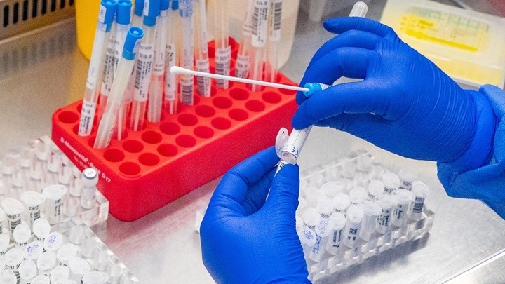 Ευλογιά των πιθήκων: 50 τα κρούσματα ευλογιάς των πιθήκων στην Ελλάδα