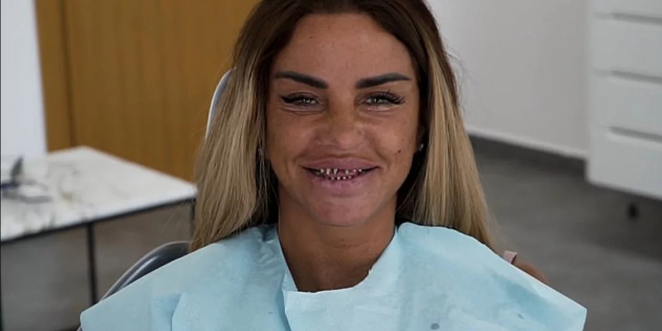 Χαμός με το hashtag #Turkeyteeth: Πηγαίνουν για θεραπεία στα δόντια τους και γυρνούν με απίστευτους πόνους (pics)