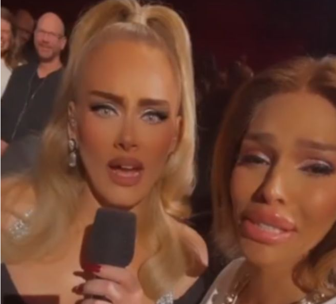Επική η αντίδραση της Adele: «Θεέ μου, τι έκανες στο πρόσωπό μου;»