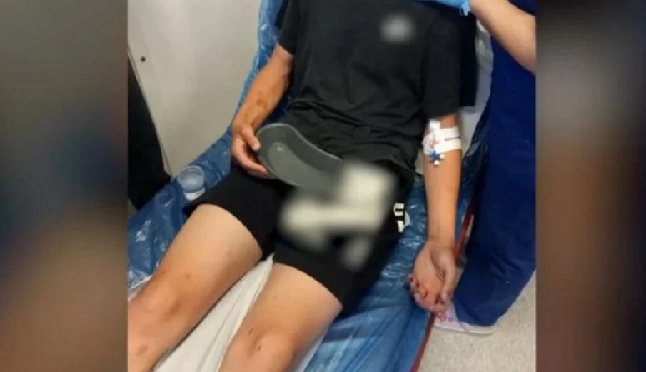 Καλαμάτα: Ξέσπασε η μητέρα του 16χρονου που ξυλοκόπησαν ανήλικοι