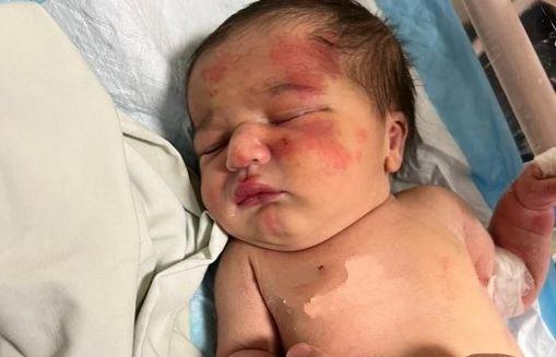 Συγκλονιστική ιστορία: Αδέσποτος σκύλος έσωσε βρέφος που το είχαν πετάξει στα σκουπίδια