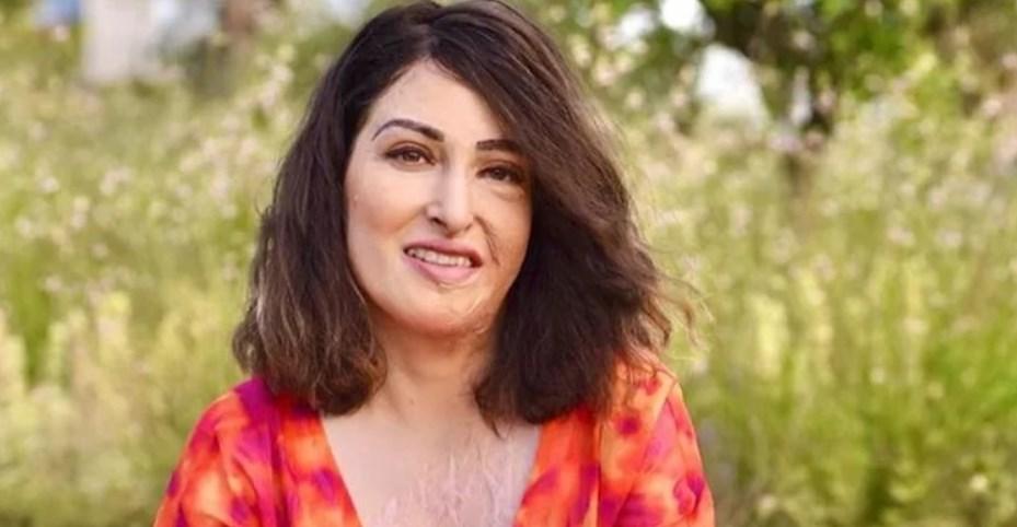 Η Ιωάννα Παλιοσπύρου αποκαλύπτει τις συνέπειες της επίθεσης με το βιτριόλι και μιλάει για τα εγκαύματα που υπέστη: “Εκείνη την ημέρα βρισκόμουν σε έκσταση…”