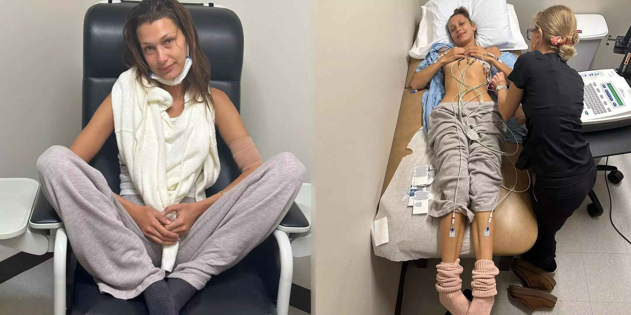 Bella Hadid: Η μάχη με τη νόσο του Lyme