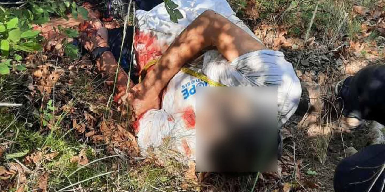 Άνδρας δέχτηκε επίθεση από αρκούδα στα Τρίκαλα – «Άρχισε να τον δαγκώνει κι αυτός δε μπορούσε να αντιδράσει» (ΦΩΤΟ & ΒΙΝΤΕΟ)