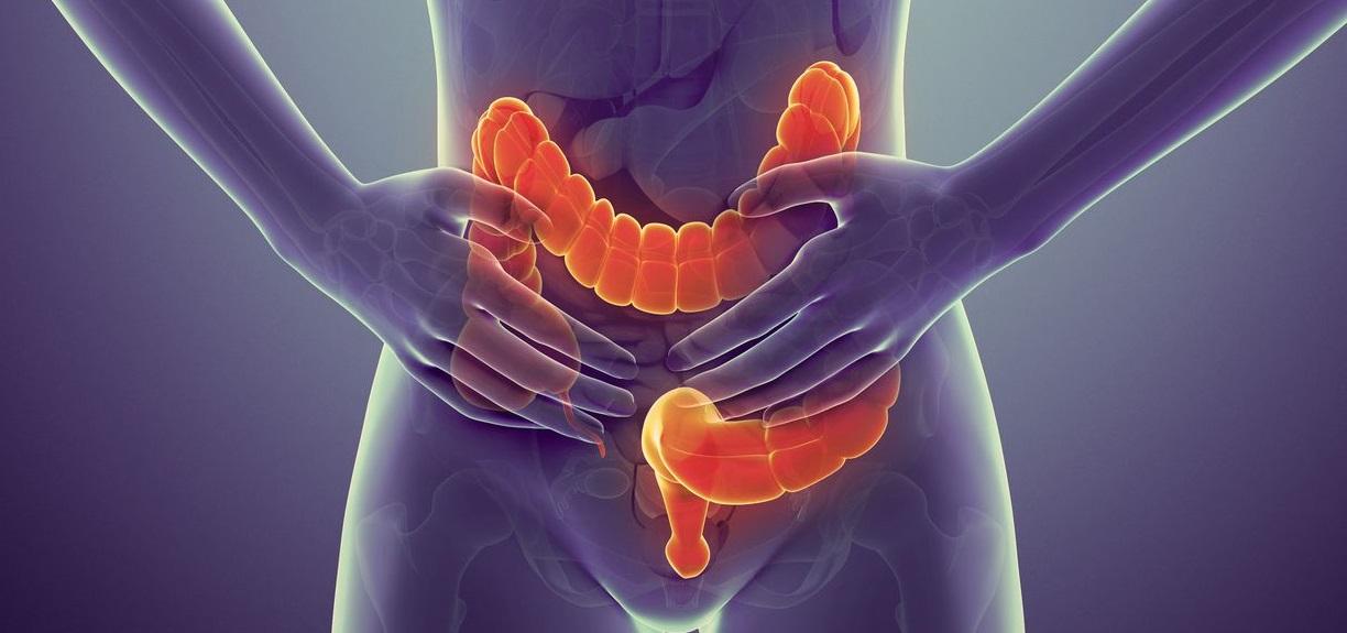 Σύνδρομο Ευερέθιστου Εντέρου: Οι τροφές που φουσκώνουν