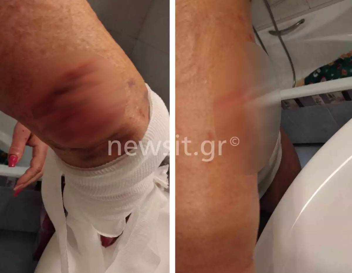 Ραφήνα – Όσα λέει η άτυχη γυναίκα: «Ήμουν τυχερή, μπορούσα να πάθαινα κάτι χειρότερο»