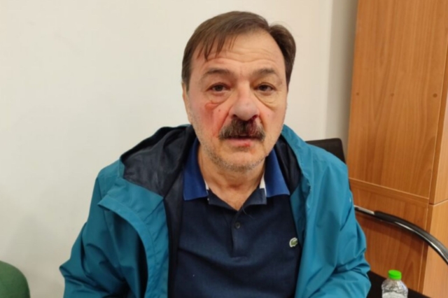 Ξυλοδαρμός από δημοτικό σύμβουλο του Μπέου: Προκαταρκτική εξέταση στον Βόλο