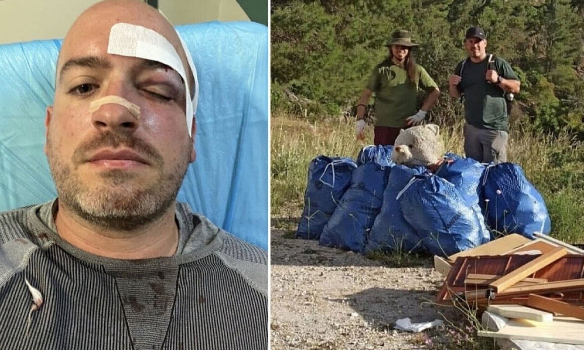 Αττική: Παραμένουν άφαντοι οι επτά δράστες της επίθεσης σε βάρος των εθελοντών στην Πάρνηθα