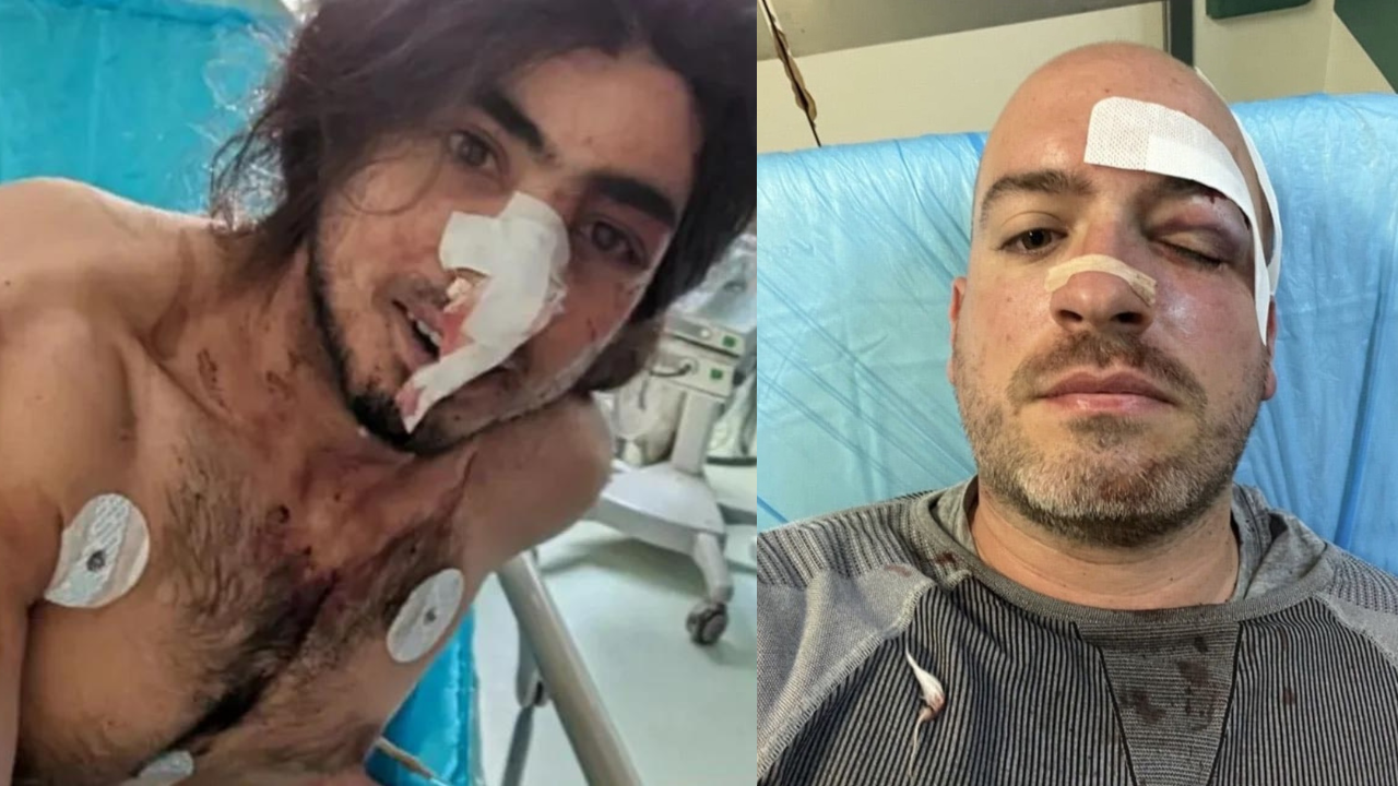 Πάρνηθα | Μαχαίρωσαν εθελοντές που πήγαν να καθαρίσουν το βουνό