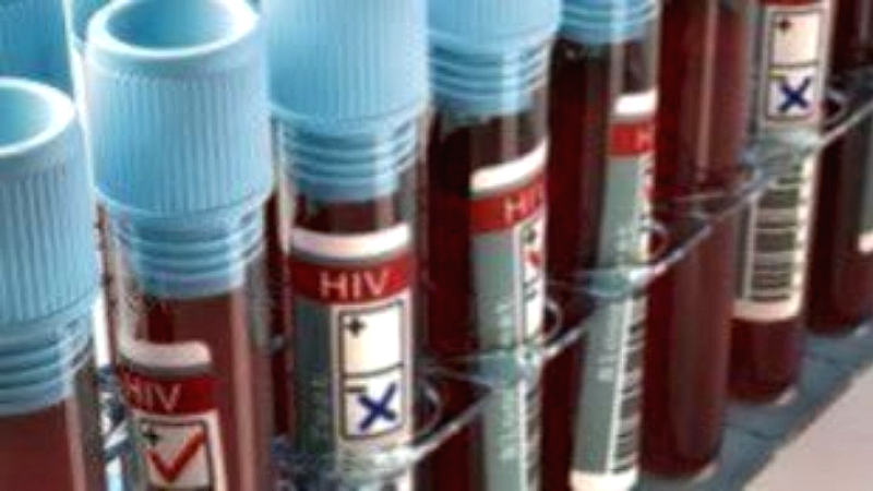 Η πρόοδος στον αγώνα κατά του HIV και του AIDS: Σημαντικά βήματα και προκλήσεις