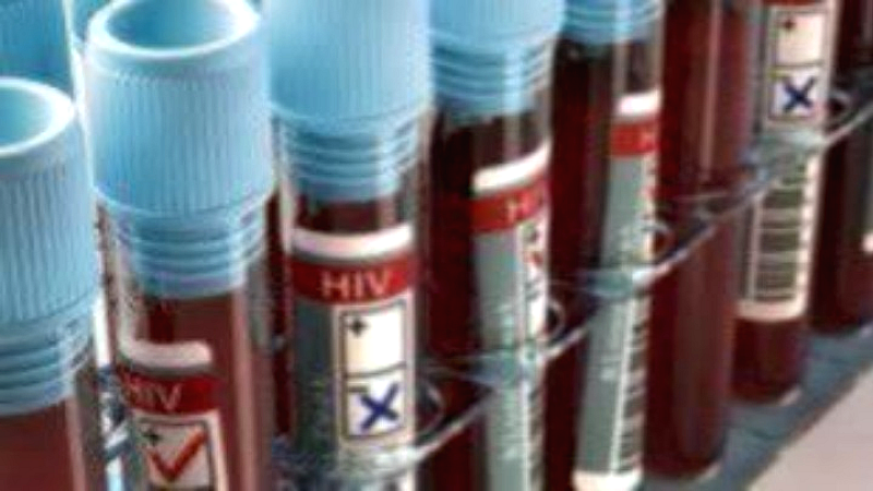 Προειδοποίηση του ΟΗΕ για την αναζωπύρωση της πανδημίας του AIDS λόγω της διακοπής της αμερικανικής βοήθειας