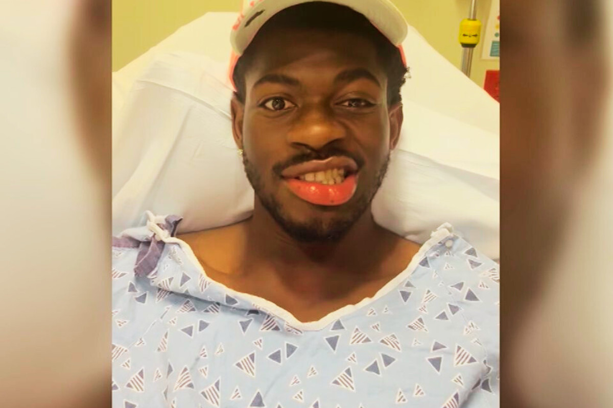 Lil Nas X: Νοσηλεύεται μετά από παράλυση στη δεξιά πλευρά του προσώπου