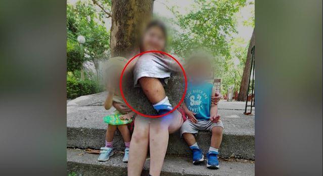 Λάρισα: Σοκαριστικές φωτογραφίες ντοκουμέντο από τα καψίματα των δύο παιδιών