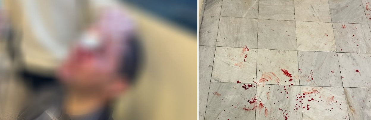 Αιματηρή εισβολή κουκουλοφόρων στη Νομική: «Τελειώσατε τώρα» – Βαρύς τραυματισμός φοιτητή, ξυλοδαρμός με κράνη και λοστούς