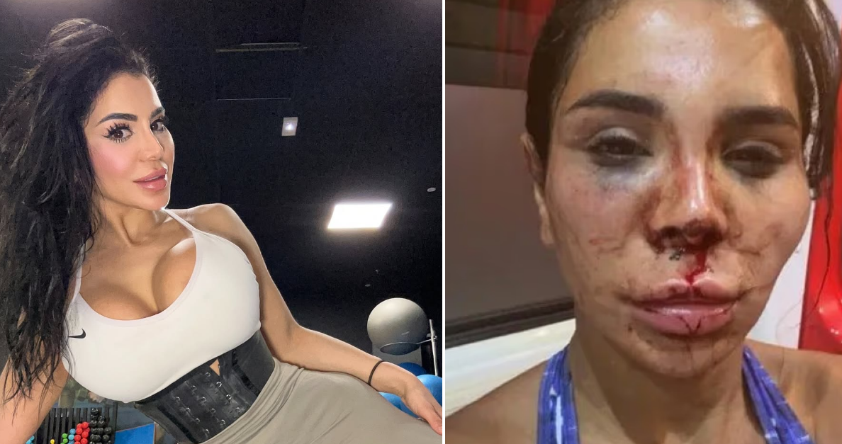 Τρόμος για 30χρονη influencer στη Μασσαλία: Διαρρήκτες την χτύπησαν, την έδεσαν και την έλουσαν με χλωρίνη – Πιθανότατα την βίασαν