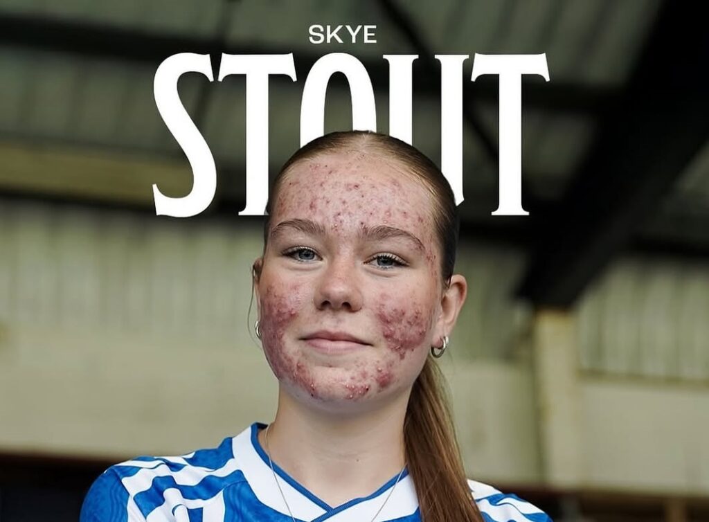 Skye Stout: Η 16χρονη ποδοσφαιρίστρια που αντέτεινε στο διαδικτυακό μπούλινγκ με ένα εντυπωσιακό γκολ