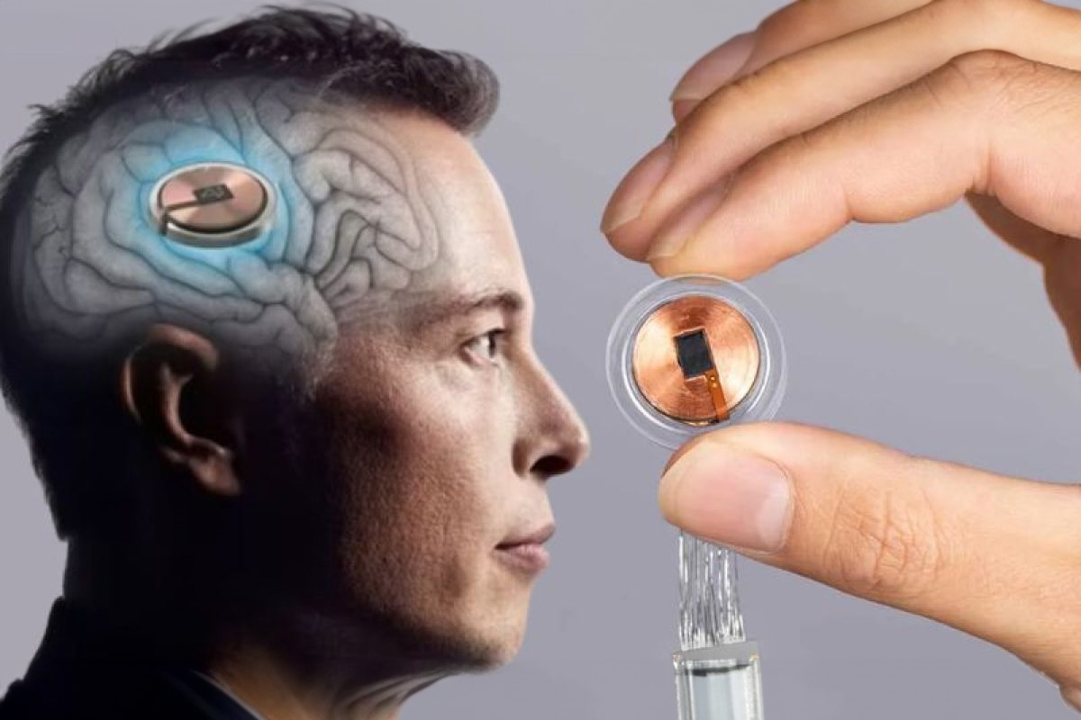 Έλον Μασκ: Τα νέα τσιπ εγκεφάλου της Neuralink θα αντικαταστήσουν τα smartphones – Αποστολή μηνυμάτων και έλεγχος συσκευών με το μυαλό