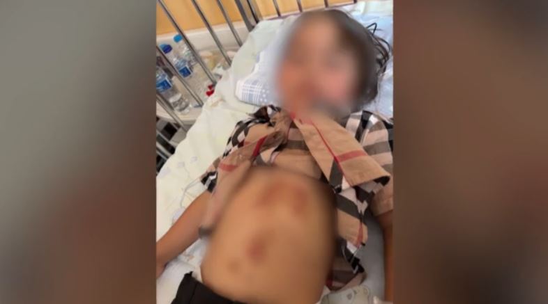 Χαλκιδική: Επιθέσεις λύκου δημιουργούν ανησυχία στους κατοίκους και τους τουρίστες