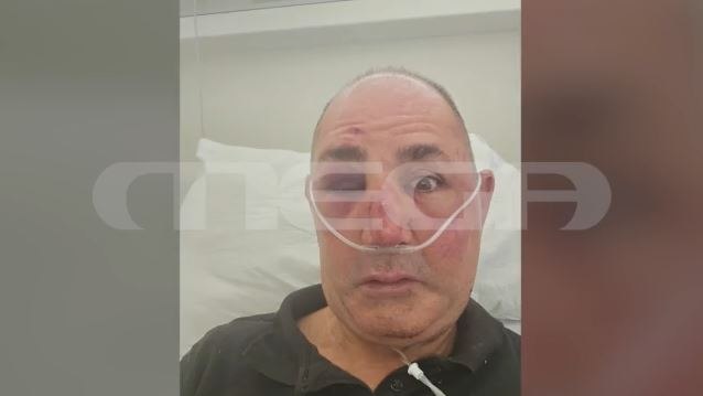 Ρόδος: Σοκάρουσες λεπτομέρειες από την άγρια επίθεση σε κοσμηματοπώλη