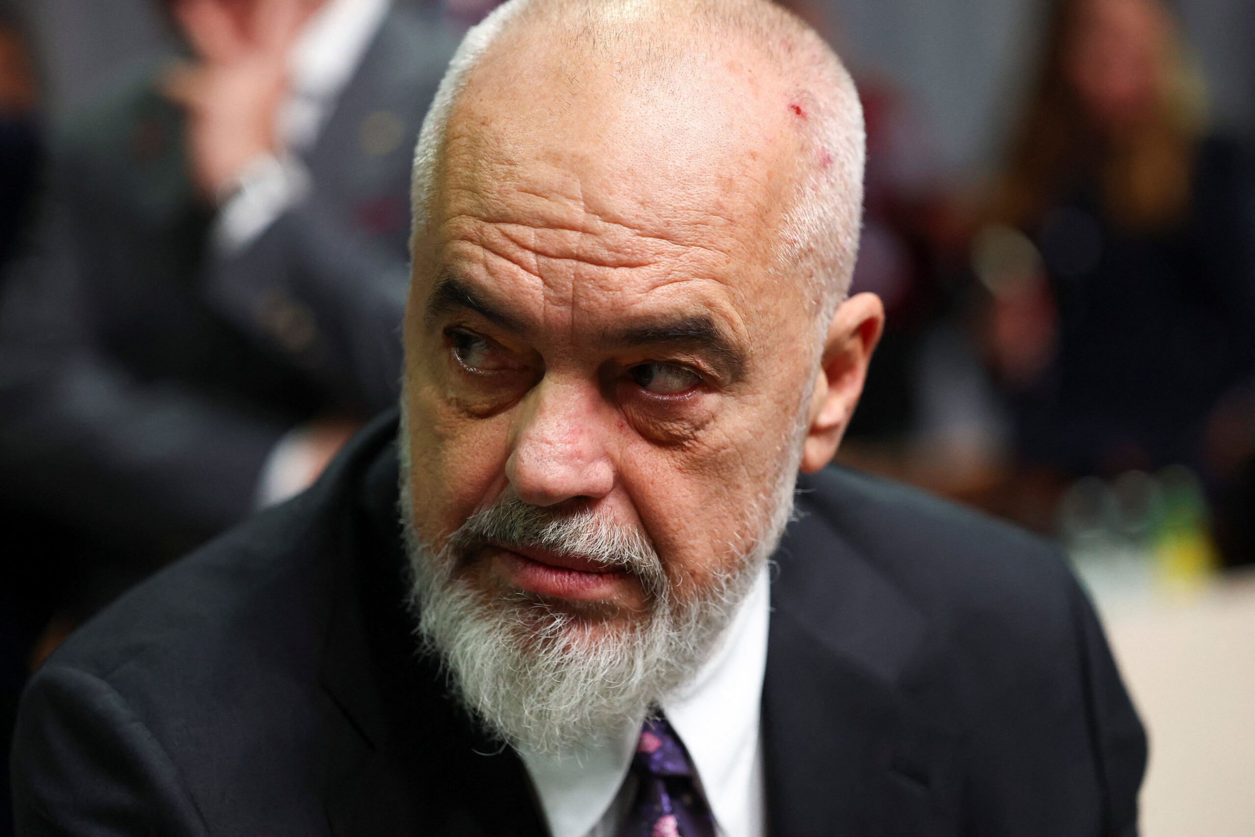 Ο Έντι Ράμα, πρωθυπουργός της Αλβανίας, εκπροσωπείται από γκαλερί του Βερολίνου