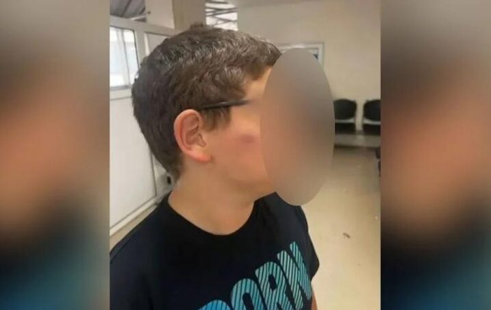 Θεσσαλονίκη: Άγριος ξυλοδαρμός 11χρονου μέσα στο σχολείο – «Το παιδί μου τρώει bullying από το 2024», λέει η μητέρα του