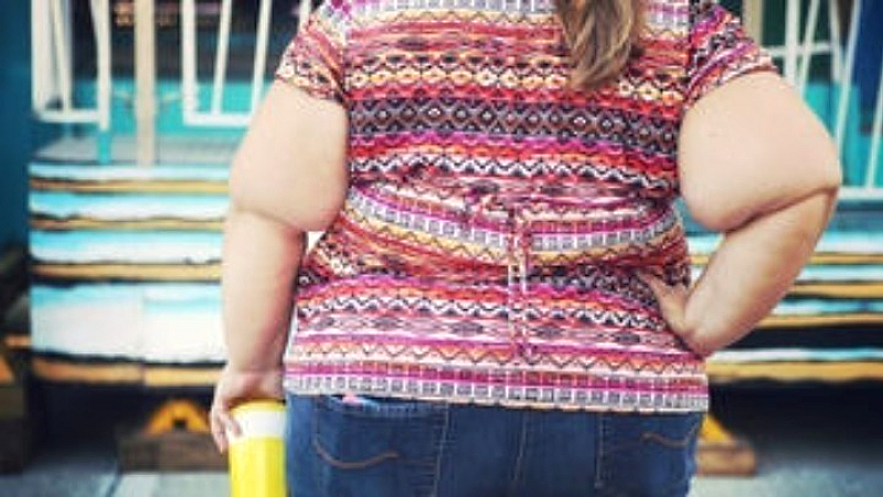 Εθνικές κατευθυντήριες οδηγίες για τη διαχείριση της παχυσαρκίας στην Ελλάδα