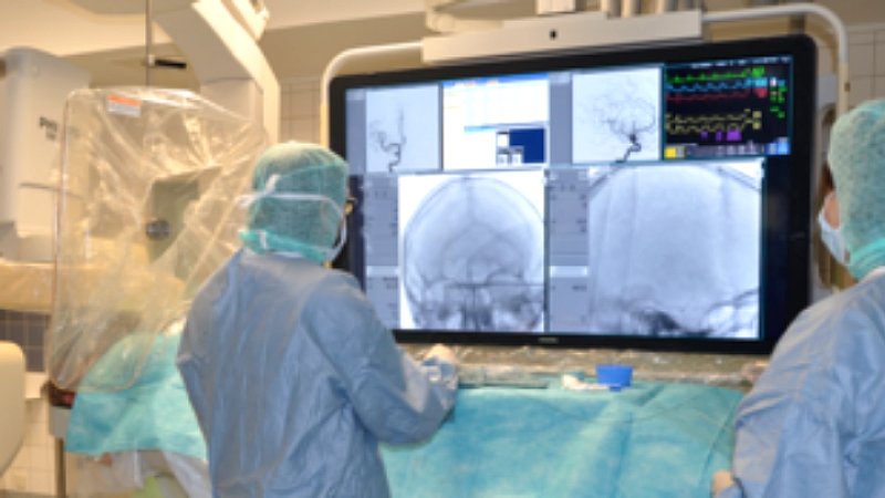 Το πρώτο Hellenic Stroke School στην Αθήνα - Σωτήρια η θεραπεία της θρομβεκτομής - Σχεδόν 35.000 εγκεφαλικά επεισόδια ετησίως στην Ελλάδα