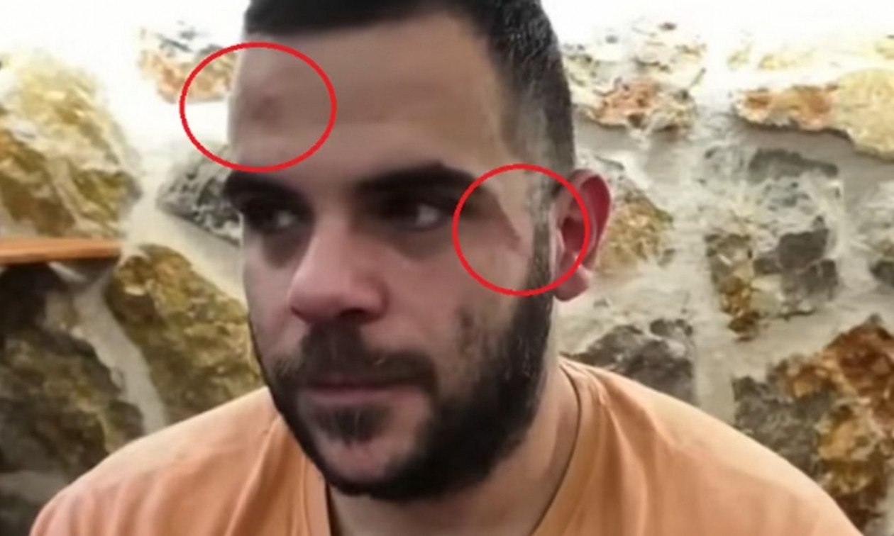 Επίθεση κατά Youtuber κατά τη διάρκεια live μετάδοσης στα Γιάννενα